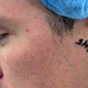 Illustration for article titled My Cyborg Ear: How a Surgeon and Titanium Cured My Lifelong Deafness